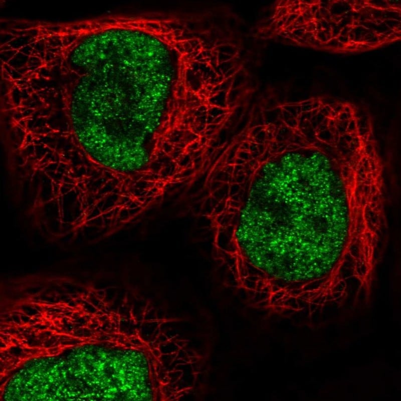 RECQL4 Antibody - BSA Free Immunocytochemistry/ Immunofluorescence: RECQL4 Antibody [NBP2-47310]