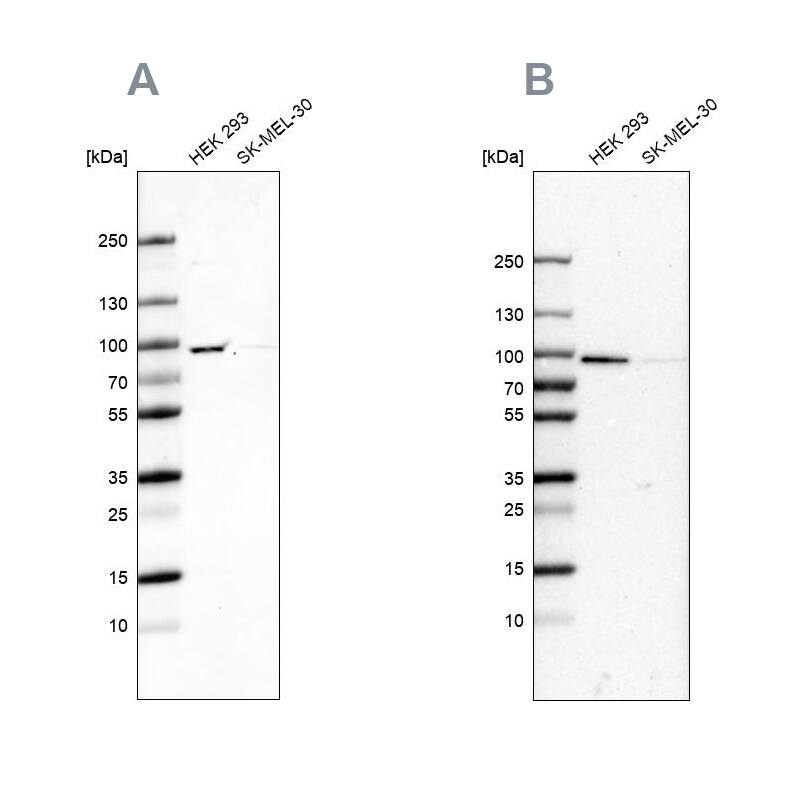 RAVER1 Antibody Western Blot: RAVER1 Antibody Antibody [NBP2-47313]