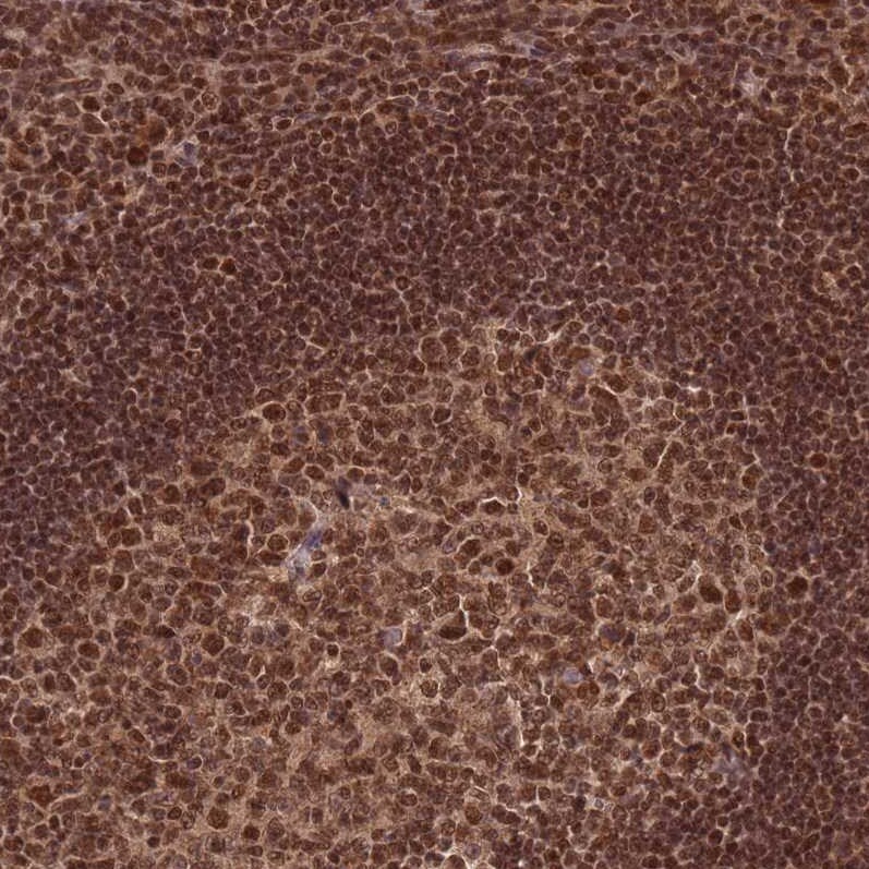 RAVER1 Antibody