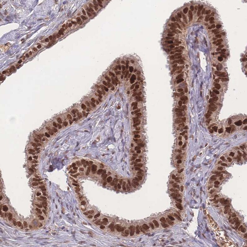 RAVER1 Antibody