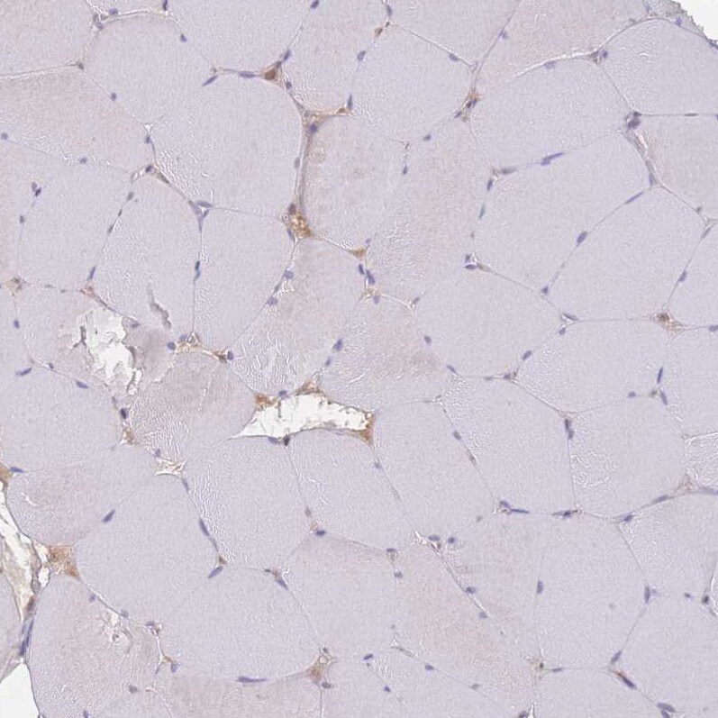 RAVER1 Antibody