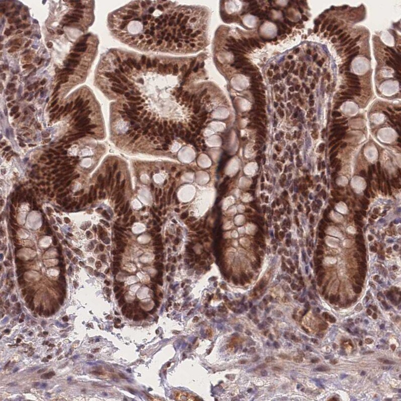 RAVER1 Antibody