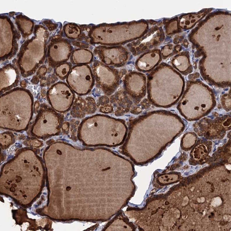 PGLS Antibody - BSA Free Immunohistochemistry-Paraffin: PGLS Antibody [NBP2-47333]