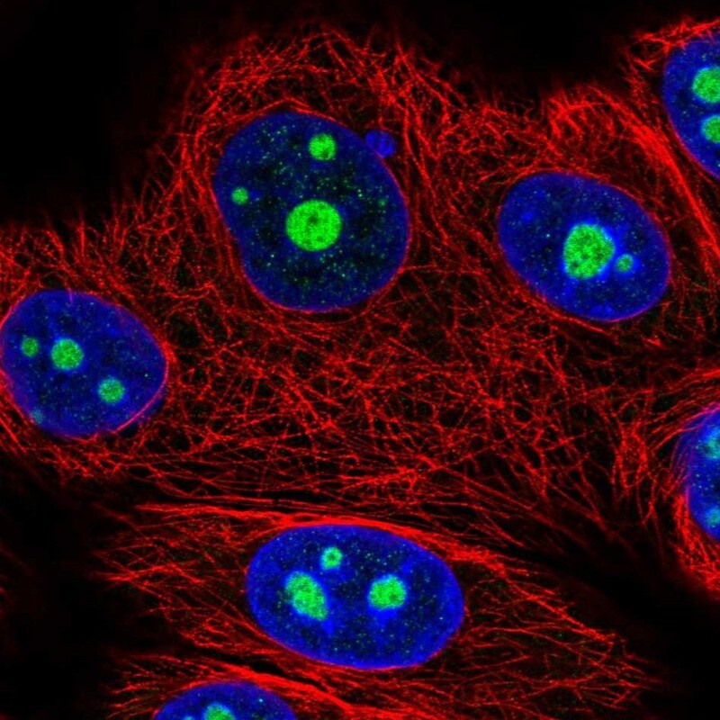 NOM1 Antibody - BSA Free Immunocytochemistry/ Immunofluorescence: NOM1 Antibody [NBP2-47352]