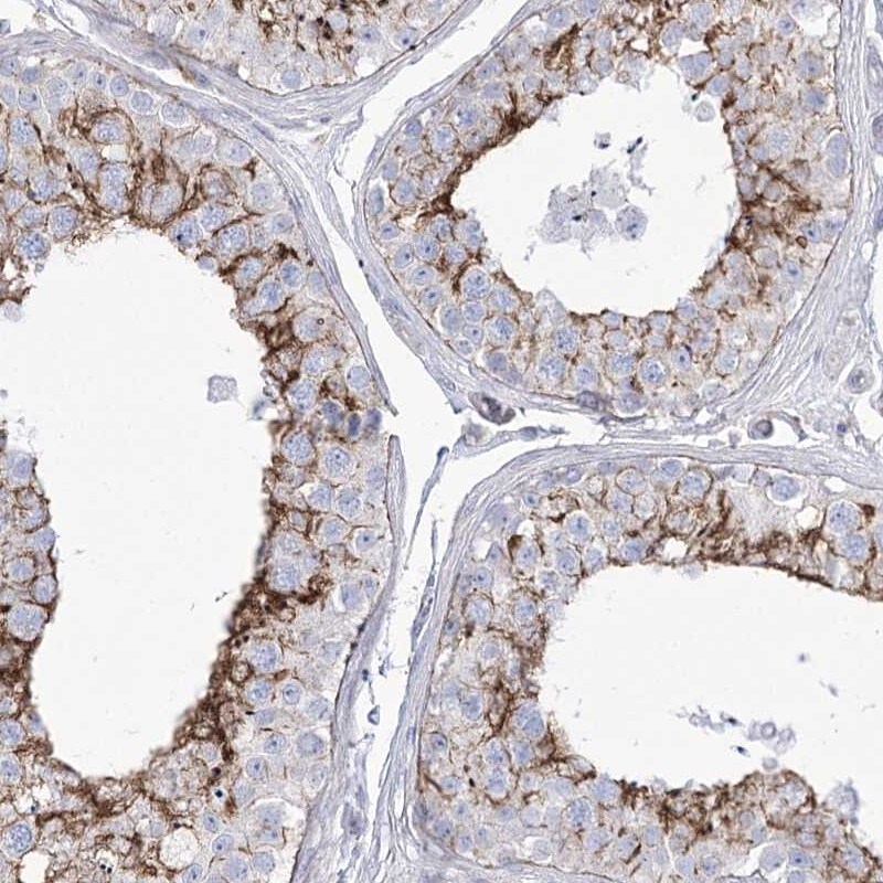 HSU79274 Antibody - BSA Free Immunohistochemistry-Paraffin: HSU79274 Antibody [NBP2-47425]