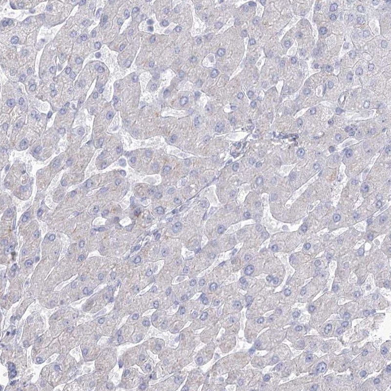 HSU79274 Antibody - BSA Free Immunohistochemistry-Paraffin: HSU79274 Antibody [NBP2-47425]