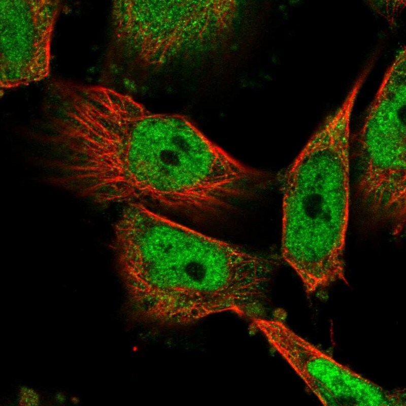 HDAC3 Antibody Immunocytochemistry/Immunofluorescence: HDAC3 Antibody [NBP2-47439]