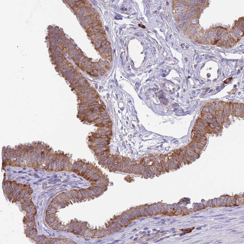 Exosome component 8 Antibody - BSA Free Immunohistochemistry-Paraffin: Exosome component 8 Antibody [NBP2-47466]