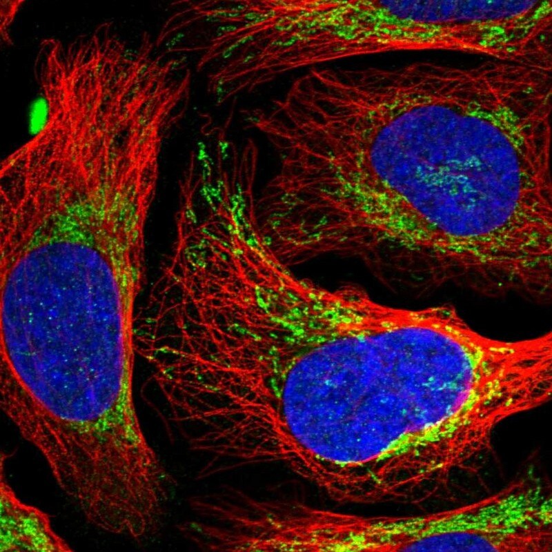EVC2 Antibody - BSA Free Immunocytochemistry/ Immunofluorescence: EVC2 Antibody [NBP2-47467]