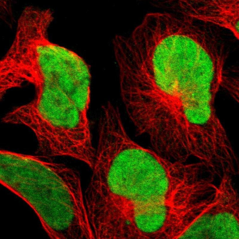 CXorf67 Antibody - BSA Free Immunocytochemistry/ Immunofluorescence: CXorf67 Antibody [NBP2-47498]