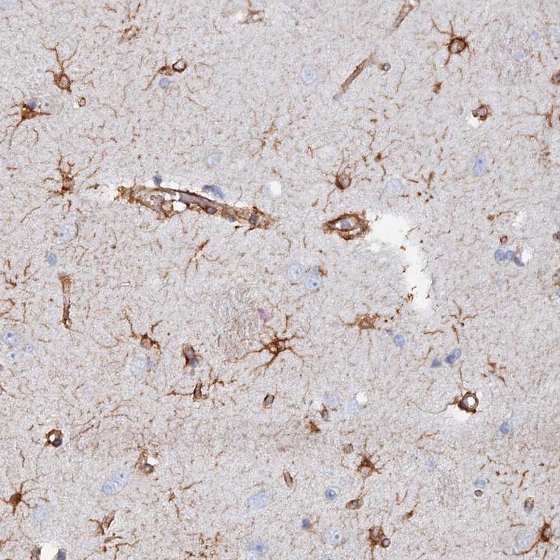 COG7 Antibody - BSA Free Immunohistochemistry-Paraffin: COG7 Antibody [NBP2-47502]