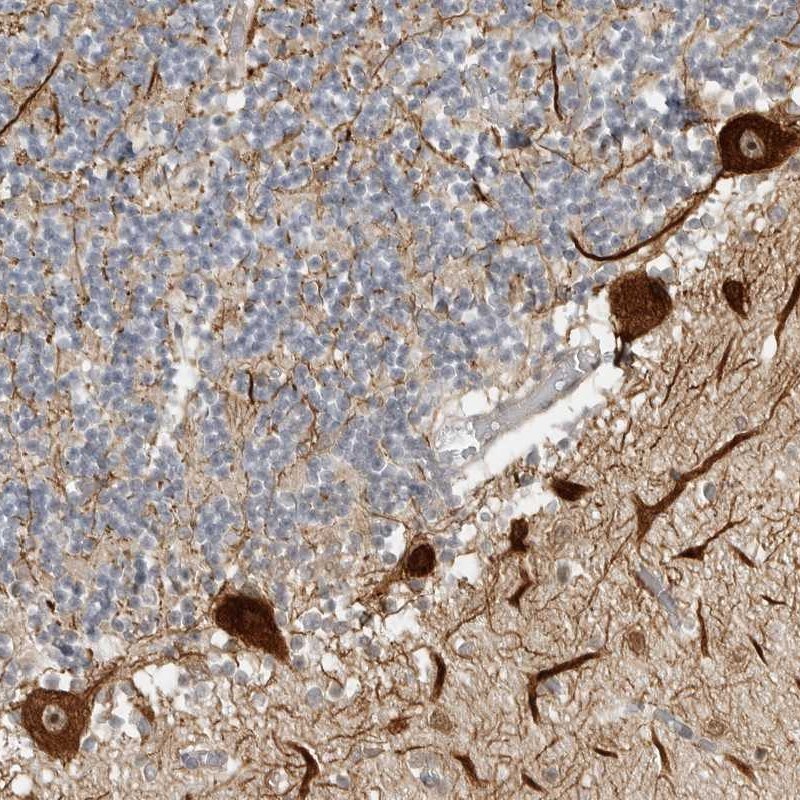 CEP295NL Antibody - BSA Free Immunohistochemistry: CEP295NL Antibody - BSA Free [NBP2-47512]