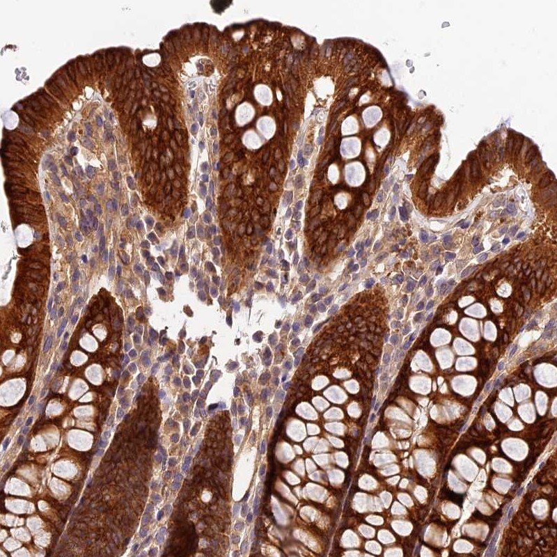 Carboxylesterase 3/CES3/Esterase 31 Antibody - BSA Free Immunohistochemistry-Paraffin: Carboxylesterase 3/CES3/Esterase 31 Antibody [NBP2-47529]