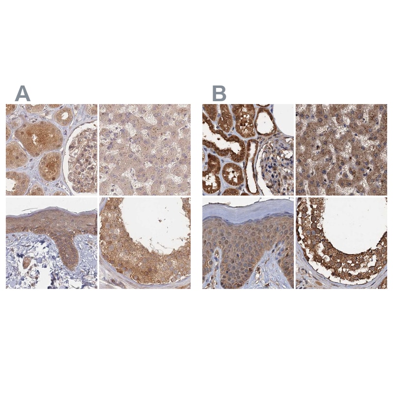 26S proteasome subunit 9 Antibody Immunohistochemistry-Paraffin: 26S proteasome subunit 9 Antibody Antibody [NBP2-47560]