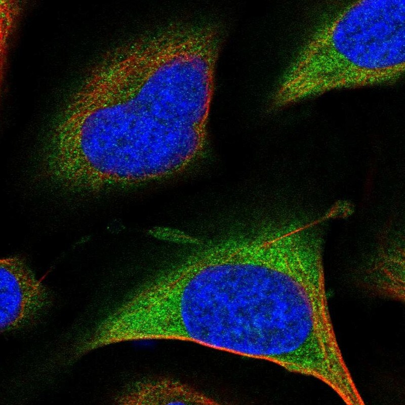26S proteasome subunit 9 Antibody Immunocytochemistry/Immunofluorescence: 26S proteasome subunit 9 Antibody [NBP2-47560]