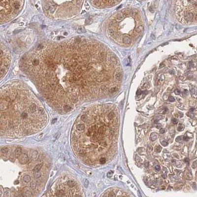 26S proteasome subunit 9 Antibody