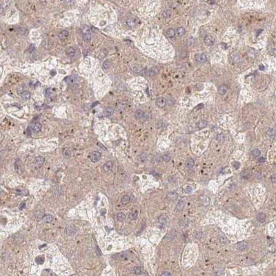 26S proteasome subunit 9 Antibody