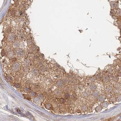 26S proteasome subunit 9 Antibody