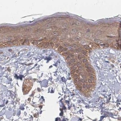 26S proteasome subunit 9 Antibody