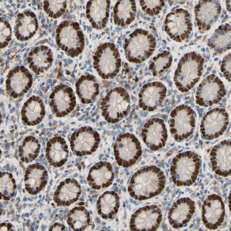 ZKSCAN3 Antibody - BSA Free Immunohistochemistry: ZKSCAN3 Antibody - BSA Free [NBP2-47570]