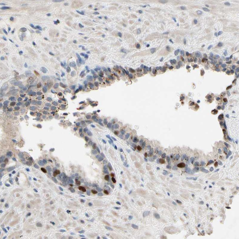 ZKSCAN3 Antibody - BSA Free Immunohistochemistry: ZKSCAN3 Antibody - BSA Free [NBP2-47570]