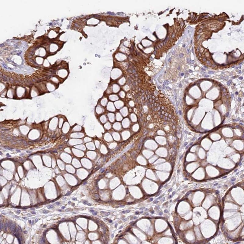 VPS11 Antibody - BSA Free Immunohistochemistry-Paraffin: VPS11 Antibody [NBP2-47583]