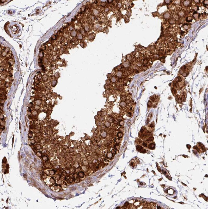 TRAP1 Antibody - BSA Free Immunohistochemistry-Paraffin: TRAP1 Antibody [NBP2-47597]
