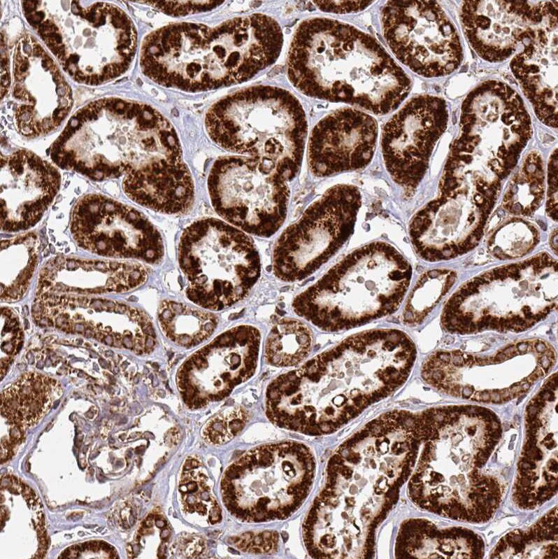 TRAP1 Antibody - BSA Free Immunohistochemistry-Paraffin: TRAP1 Antibody [NBP2-47597]