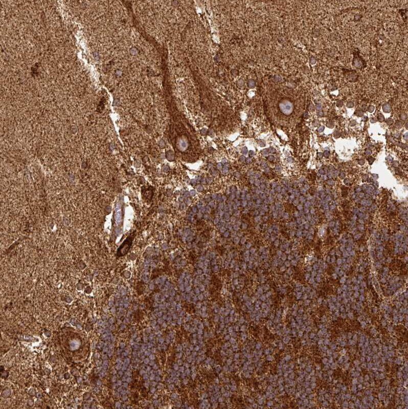 TRAP1 Antibody - BSA Free Immunohistochemistry-Paraffin: TRAP1 Antibody [NBP2-47597]