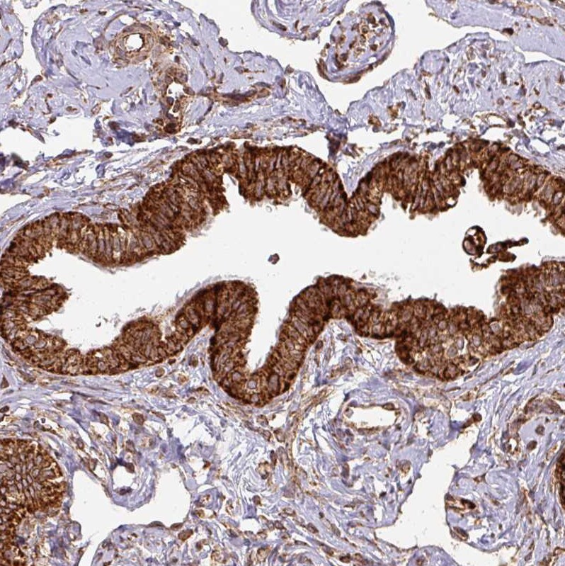 TRAP1 Antibody - BSA Free Immunohistochemistry-Paraffin: TRAP1 Antibody [NBP2-47597]