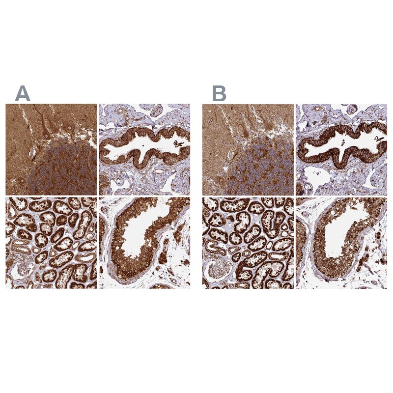 TRAP1 Antibody - BSA Free Immunohistochemistry-Paraffin: TRAP1 Antibody [NBP2-47597]