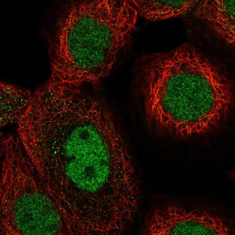 TAF148 Antibody - BSA Free Immunocytochemistry/ Immunofluorescence: TAF148 Antibody - BSA Free [NBP2-47609]