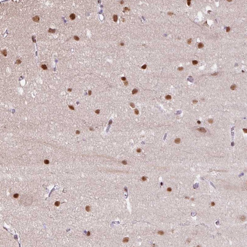 TAF148 Antibody - BSA Free Immunohistochemistry-Paraffin: TAF148 Antibody - BSA Free [NBP2-47609]