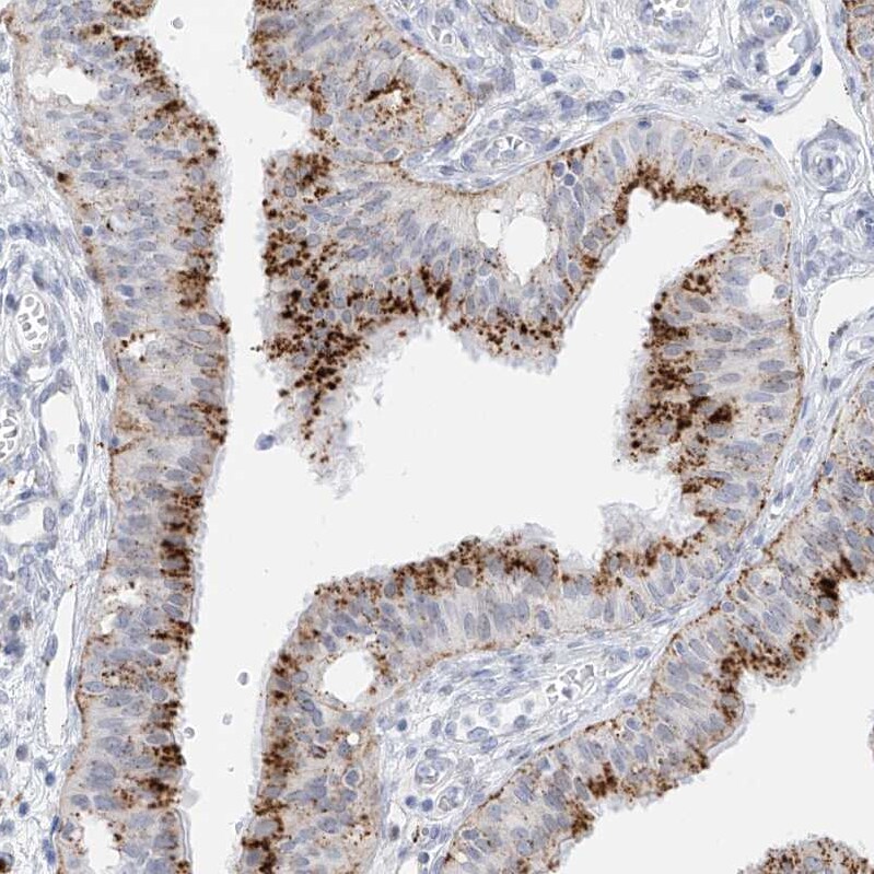 Phosphoserine phosphatase Antibody - BSA Free Immunohistochemistry: Phosphoserine phosphatase Antibody - BSA Free [NBP2-47625]