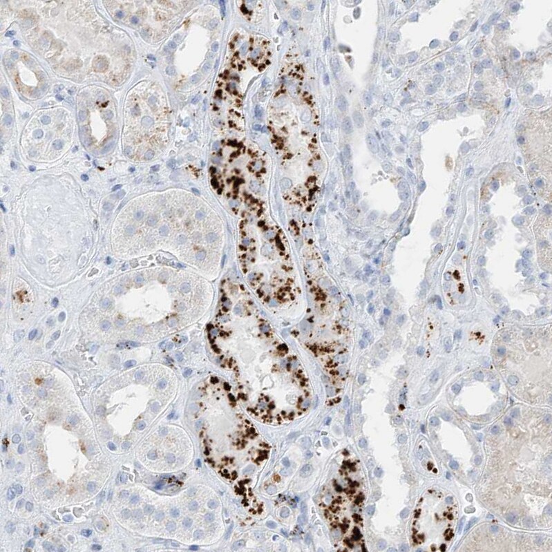 Phosphoserine phosphatase Antibody - BSA Free Immunohistochemistry: Phosphoserine phosphatase Antibody - BSA Free [NBP2-47625]