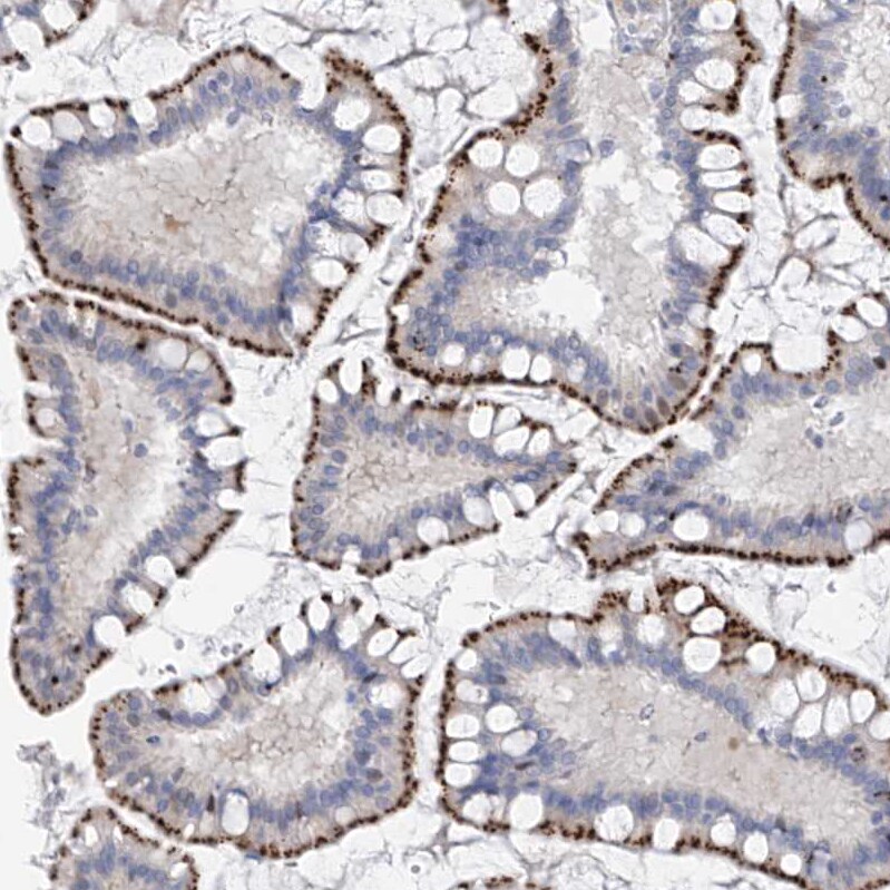Phosphoserine phosphatase Antibody - BSA Free Immunohistochemistry: Phosphoserine phosphatase Antibody - BSA Free [NBP2-47625]