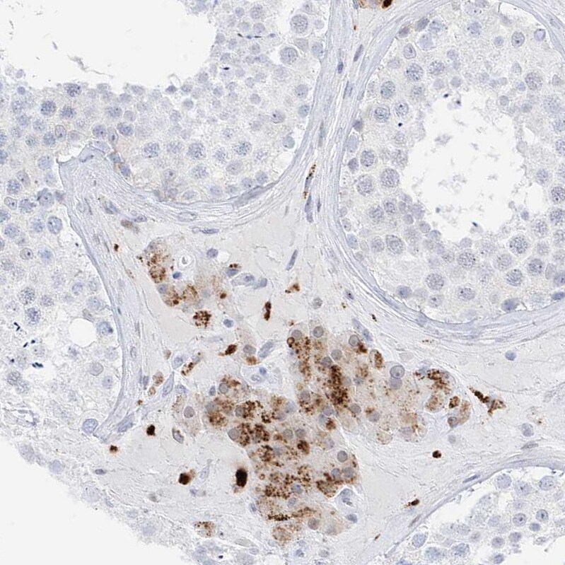 Phosphoserine phosphatase Antibody - BSA Free Immunohistochemistry: Phosphoserine phosphatase Antibody - BSA Free [NBP2-47625]