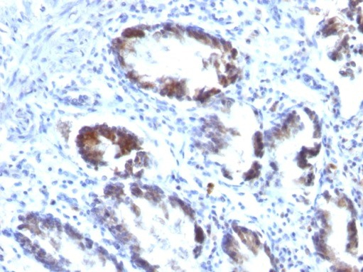 Transgelin/TAGLN/SM22 alpha Antibody (TAGLN/247) - Azide and BSA Free