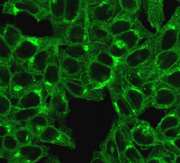 beta 2-Microglobulin Antibody (SPM617) - Azide and BSA Free Immunocytochemistry/ Immunofluorescence: beta 2-Microglobulin Antibody (SPM617) - Azide and BSA Free [NBP2-47703] -