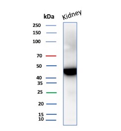 Isocitrate Dehydrogenase 1/IDH1 Antibody (IDH1/1152) - Azide and BSA Free Western Blot: Isocitrate Dehydrogenase 1/IDH1 Antibody (IDH1/1152) - Azide and BSA Free [NBP2-47744] -