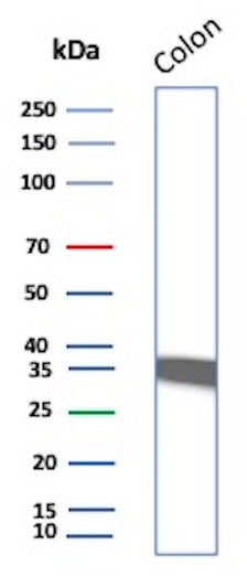 Calponin 1 Antibody (CNN1/832) - Azide and BSA Free Western Blot: Calponin 1 Antibody (CNN1/832) - Azide and BSA Free [NBP2-47757] -