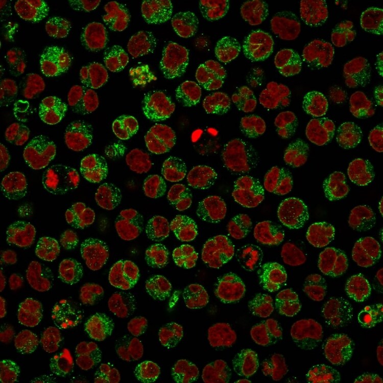 CD79A Antibody (HM47/A9) - IHC-Prediluted Immunocytochemistry/ Immunofluorescence: CD79A Antibody (HM47/A9) - IHC-Prediluted [NBP2-48028] -