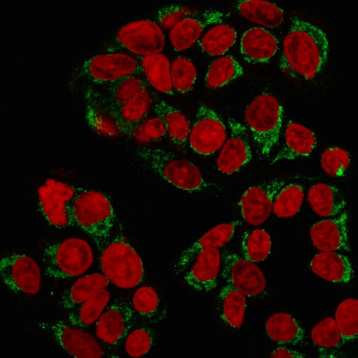 GnRHR Antibody (GNRHR/768) - IHC-Prediluted Immunocytochemistry/ Immunofluorescence: GnRHR Antibody (GNRHR/768) - IHC-Prediluted [NBP2-48039] -