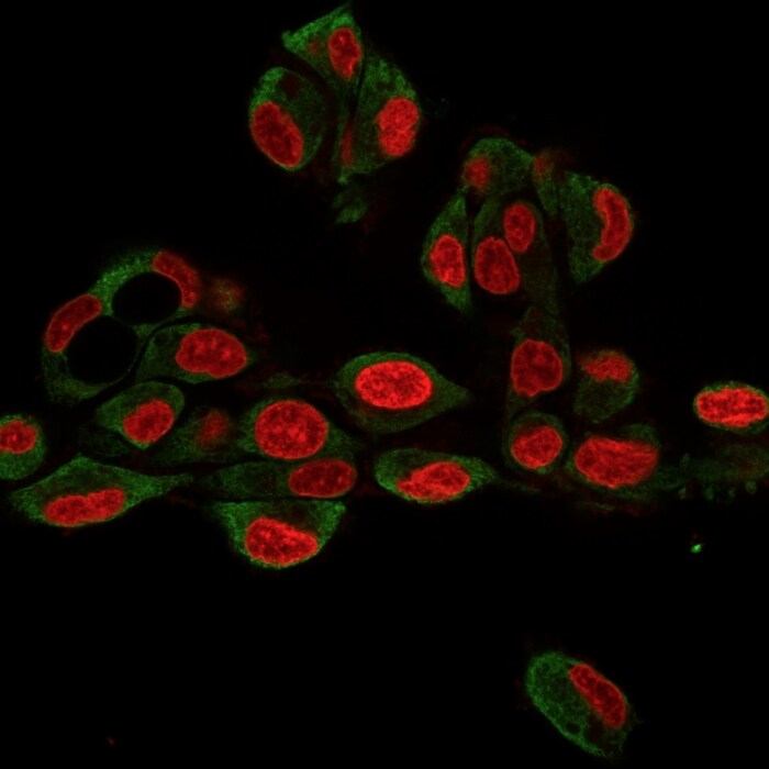 gp96/HSP90B1/GRP94 Antibody (9G10.F8.2) - IHC-Prediluted Immunocytochemistry/ Immunofluorescence: gp96/HSP90B1/GRP94 Antibody (9G10.F8.2) - IHC-Prediluted [NBP2-48046] -