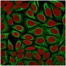 Cytokeratin 18 Antibody (KRT18/1190) - IHC-Prediluted Immunocytochemistry/ Immunofluorescence: Cytokeratin 18 Antibody (KRT18/1190) - IHC-Prediluted [NBP2-48048] -