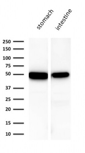 Cytokeratin 18 Antibody (KRT18/1190) - IHC-Prediluted Western Blot: Cytokeratin 18 Antibody (KRT18/1190) - IHC-Prediluted [NBP2-48048] -