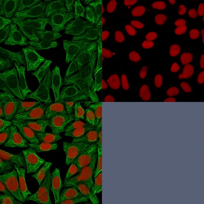 Cytokeratin 18 Antibody (DE-K18) - IHC-Prediluted Immunocytochemistry/ Immunofluorescence: Cytokeratin 18 Antibody (DE-K18) - IHC-Prediluted [NBP2-48055] -