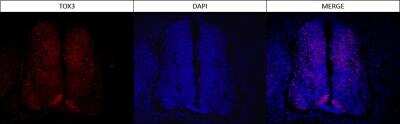 TOX3 Antibody (TOX3/1123) - IHC-Prediluted Immunocytochemistry/ Immunofluorescence: TOX3 Antibody (TOX3/1123) - IHC-Prediluted [NBP2-48059] -