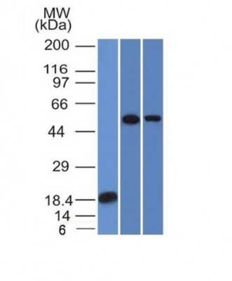 TOX3 Antibody (TOX3/1124) - IHC-Prediluted Western Blot: TOX3 Antibody (TOX3/1124) - IHC-Prediluted [NBP2-48060] -