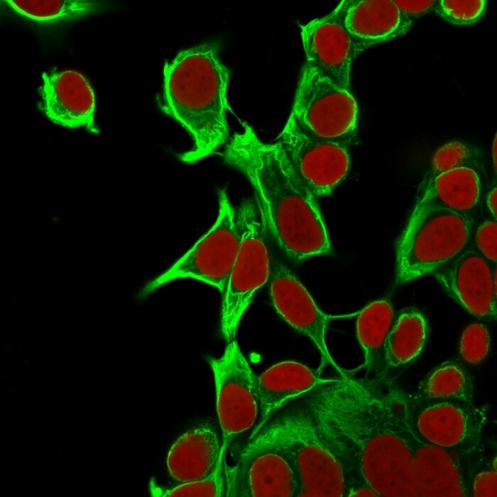 Cytokeratin 18 Antibody (KRT18/835) - IHC-Prediluted Immunocytochemistry/ Immunofluorescence: Cytokeratin 18 Antibody (KRT18/835) - IHC-Prediluted [NBP2-48065] -